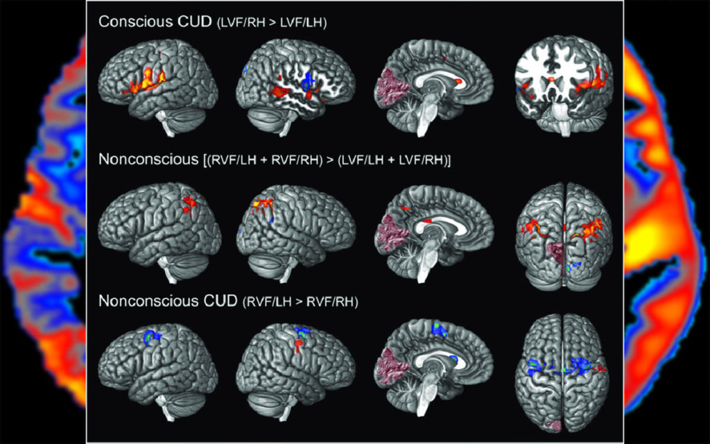 Consciousness and Brain Activity: 